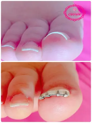 ネイル CROWN プライベートサロンのネイルデザイン