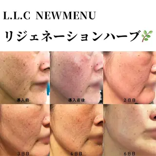 L.L.C所属・〜L.L.C〜 阿波座,中之島のエステ・リラクイメージ