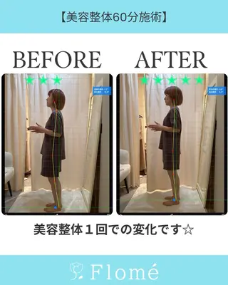 メンズ Flome(フロメ)所属・森本 想大のエステ・リラクイメージ