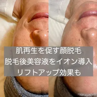 Stella sugaringのエステ・リラクイメージ