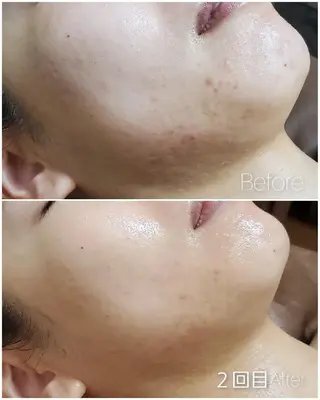 ALOHA RETREATのエステ・リラクイメージ