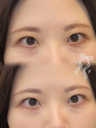 マツエク・マツパ nicott. renaのマツエク・マツパデザイン