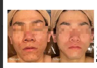 Total Beauty salon Bloom所属・肌育WISHpro 専門サロンBloomのエステ・リラクイメージ