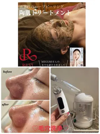 ハーブピーリング/韓国肌管理/フェイシャル/毛穴洗浄/眉毛/顔脱毛【糸脱毛専門】rev所属・ハーブピーリング🌹 毛穴洗浄❤️眉waxのエステ・リラクイメージ