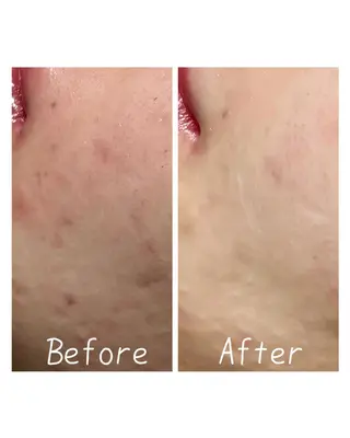 肌質改善Charme coco  増毛のエステ・リラクイメージ