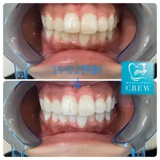 ホワイトニング ⚓︎CREW柏⚓︎のその他イメージ