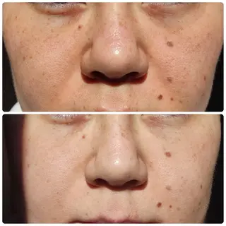 Moki Amandaのエステ・リラクイメージ