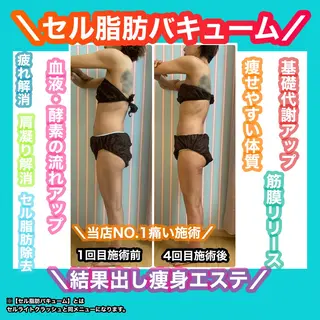 痩身/脱毛/ネイル HARUKAのエステ・リラクイメージ