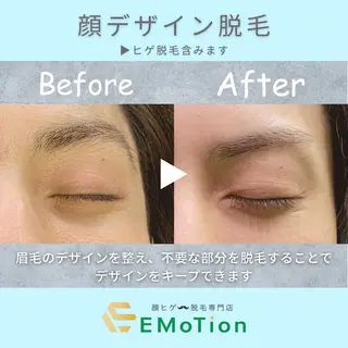 メンズ 顔ヒゲ脱毛専門店 EMoTionのエステ・リラクイメージ