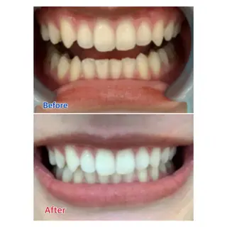 MBEAUTYSALON 千葉店・京成大久保所属・Melty 輝のその他イメージ