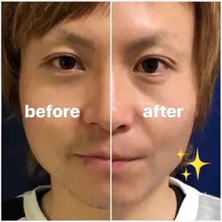 B.glad所属・ブラジリアンワックス 全身脱毛B.gladのエステ・リラクイメージ