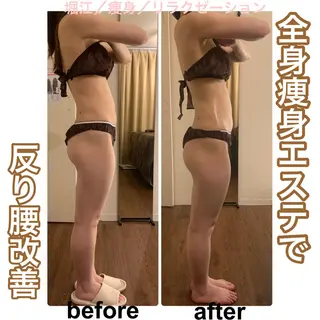 bellissimo 【ベリッシモ】所属・ちひろ　痩身/ハーブ bellissimoのエステ・リラクイメージ