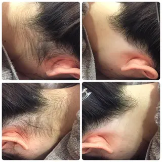 美肌脱毛・ハーブピーリング専門店Larin la beaute所属・Larin la beauteのエステ・リラクイメージ