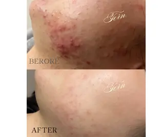 小顔・ニキビ・肌管理 TERN 南草津店のエステ・リラクイメージ