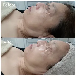 肌質改善Beauty salon Renのエステ・リラクイメージ