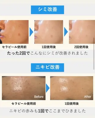 MUKU aiのエステ・リラクイメージ