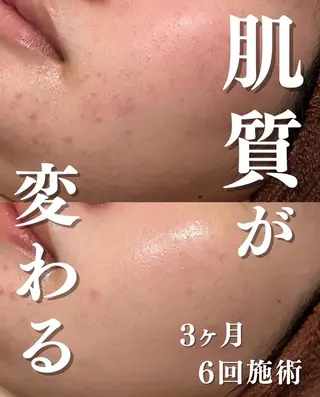 触れたくなる モテ肌へ...❤︎のエステ・リラクイメージ