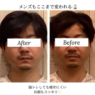 渋谷小顔矯正 毛穴洗浄ウミのエステ・リラクイメージ