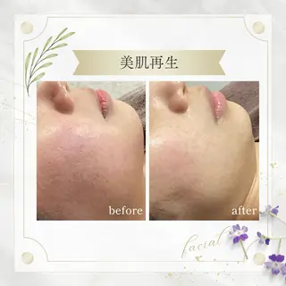 《 肌質×美肌 》 addissimoのエステ・リラクイメージ