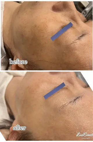 De I'm 名古屋栄店所属・原 いず美のエステ・リラクイメージ