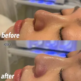 HAREHADA 🫧/ Ibukiのその他イメージ