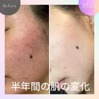 ニキビ改善専門店 d'Albaのエステ・リラクイメージ