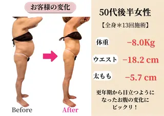 Belle White所属・本格痩身＊肌質改善＊ BelleWhiteのエステ・リラクイメージ