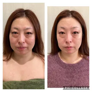 ナウフィールド 今野のエステ・リラクイメージ