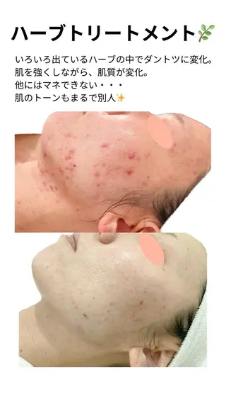 東浦町 サロンドゥエスのエステ・リラクイメージ