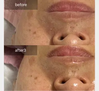 ALIA Scintiller  アリアサンティエ所属・齋藤 祐里耶のエステ・リラクイメージ