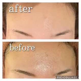 ショート カラー パーマ ヘアアレンジ メンズ キッズ ネイル マツエク・マツパ アイブロウ ニキビ特化型エステ 🍓最短で肌質改善のエステ・リラクイメージ