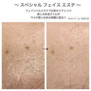 ビューティー ミロワールのエステ・リラクイメージ