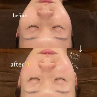 oyam オヤムのエステ・リラクイメージ