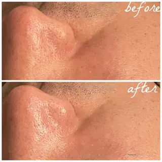 メンズ メナード岐阜市茜部 杉浦のエステ・リラクイメージ