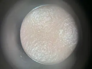 肌質改善サロン 来店プレゼントありのエステ・リラクイメージ