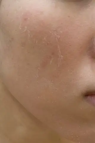 clé skin 🌿ハーブピーリングのエステ・リラクイメージ