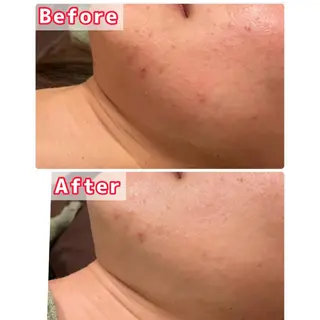 ハーブピーリング専門 muro.のエステ・リラクイメージ