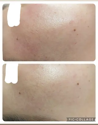 エステ&ヘアー ALPHA PLUS所属・エステ&ヘアー ALPHA PLUSのエステ・リラクイメージ