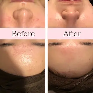 毛穴ニキビ専門 ビューティーグランツのエステ・リラクイメージ