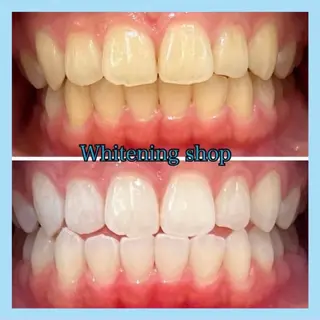 ホワイトニング ショップ千葉店のその他イメージ