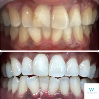 ホワイトニングショップ奈良生駒店所属・乾 理望のエステ・リラクイメージ