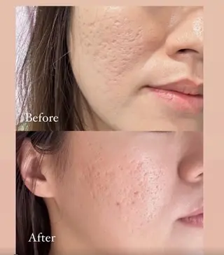 マツエク・マツパ aliaハイフ&水光ジェットサロン所属・aliaハーブ水光店 エステティシャン募集のエステ・リラクイメージ