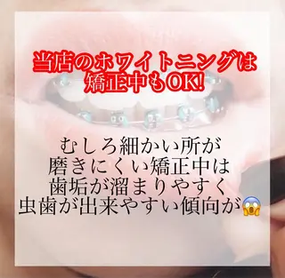 LAVISH nail salonのネイルデザイン