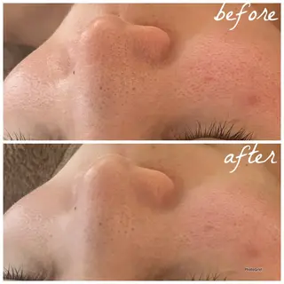 メンズ メナード岐阜市茜部 杉浦のエステ・リラクイメージ