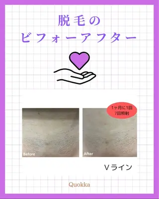 Quokka ✴︎ あま市甚目寺のエステ・リラクイメージ