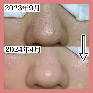 毛穴&リンパマッサージ専門サロン　花のWA所属・毛穴&リンパマッサー ジ専門サロン花のWAのエステ・リラクイメージ