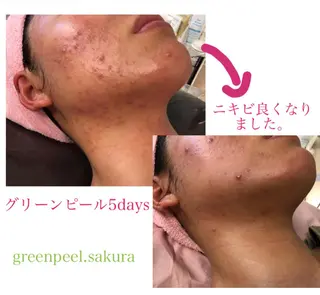 鈴木 さくらのエステ・リラクイメージ