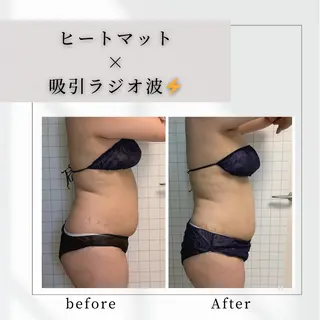 小顔矯正専門店 【RED】池田のエステ・リラクイメージ