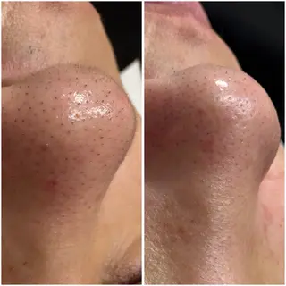 yuuri. Sの眉毛・アイブロウイメージ