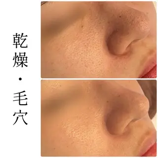 ハーブピーリング専門 BIOEL横浜のエステ・リラクイメージ